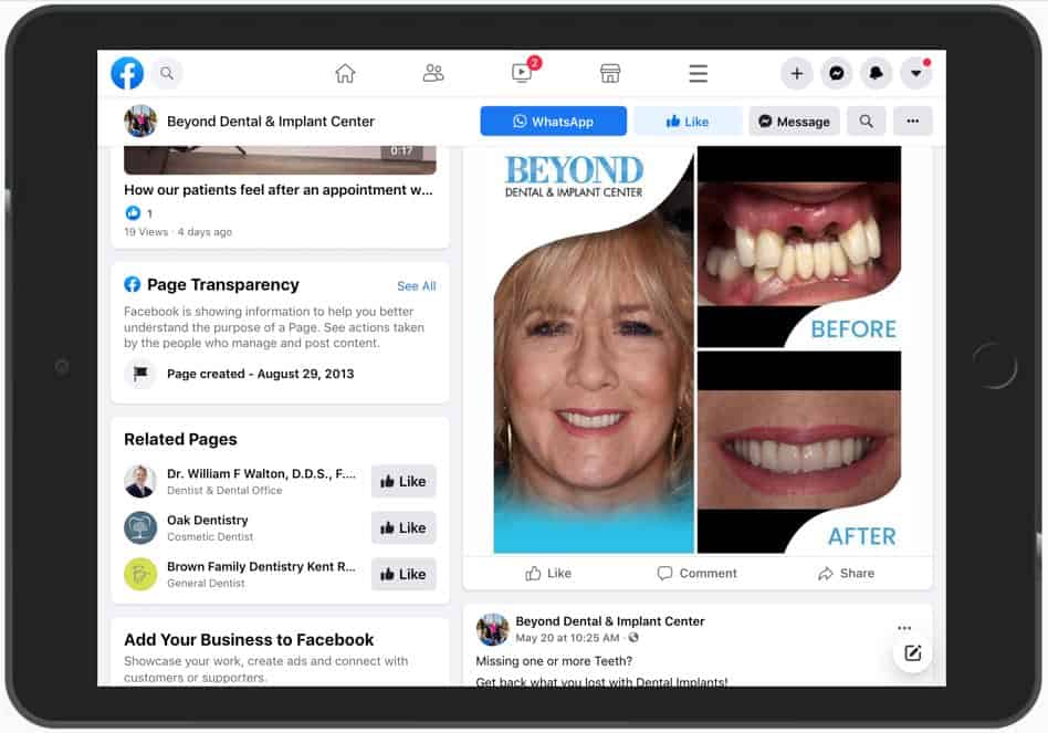 Example of social media content post. Before and after image of a patient treatment. Dental practice located in Dallas DFW area of Texas.