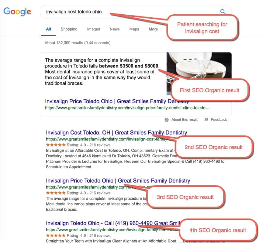Medical SEO Example 1 : Patient Searching for “invisalign cost toledo ohio” Medical SEO Example 1 : Patient Searching for “invisalign cost toledo ohio”
