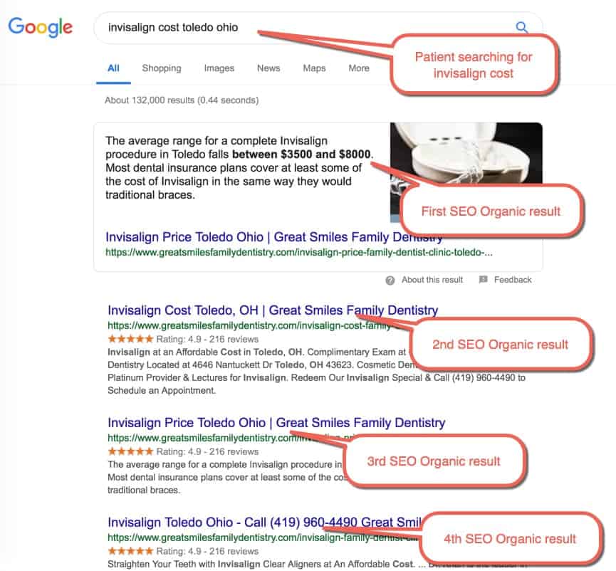 Dental SEO Example 4: Patient searching for Invisalign cost. Patient located in Toledo Ohio