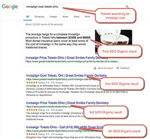 Medical SEO Example 1 :  Patient Searching for “invisalign cost toledo ohio”