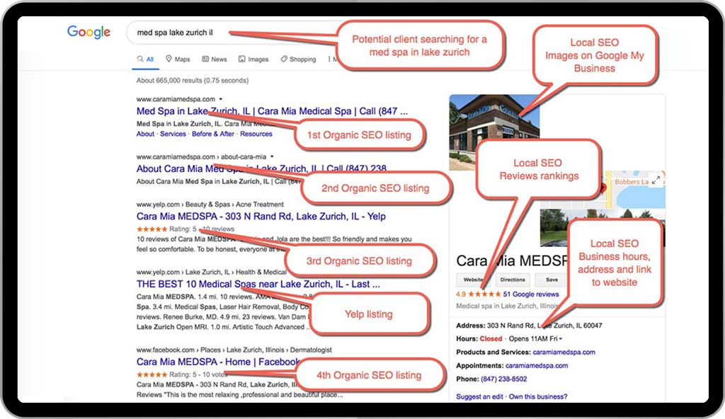 Local Medspa SEO Example 2 :  Potential client Searching for “med spa lake zurich il”