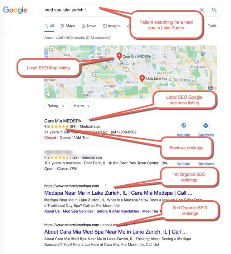 Medical SEO Example 3 : Patient Searching for “med spa lake zurich ” Medical SEO Example 3 : Patient Searching for “med spa lake zurich ”