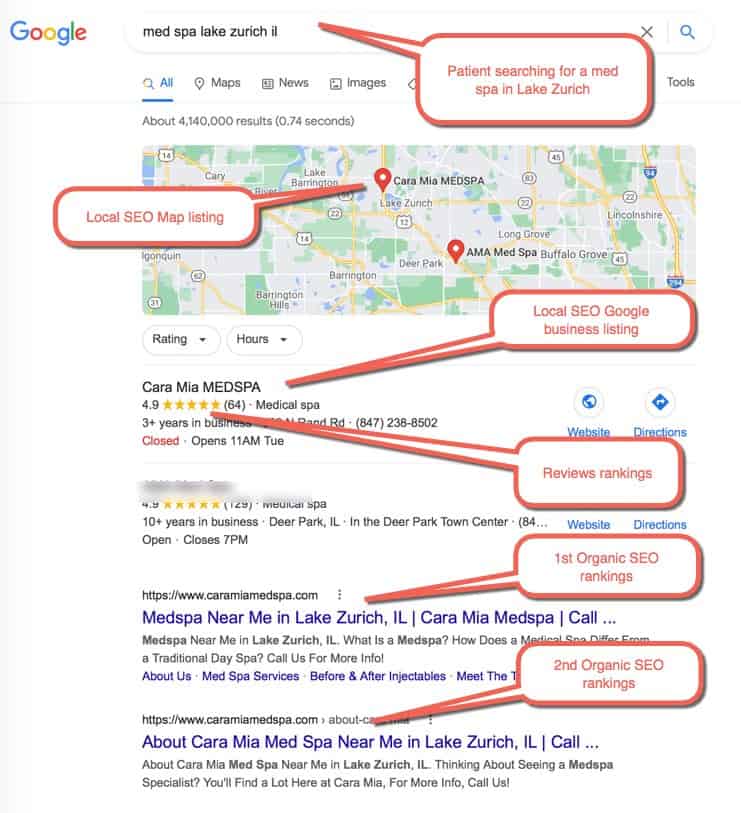 Medical SEO Example 3 :  Patient Searching for “med spa lake zurich ”