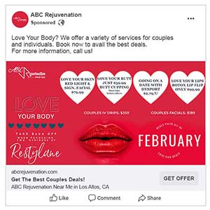 Medical spa advertising example 2: Facebook ad for "Love your lips Botox lip flip" Medical spa advertising example 2: Facebook ad for "Love your lips Botox lip flip"