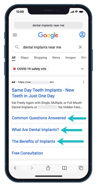 Dental SEO example: Patient looking for "dental implants near me" Dental SEO example: Patient looking for "dental implants near me"