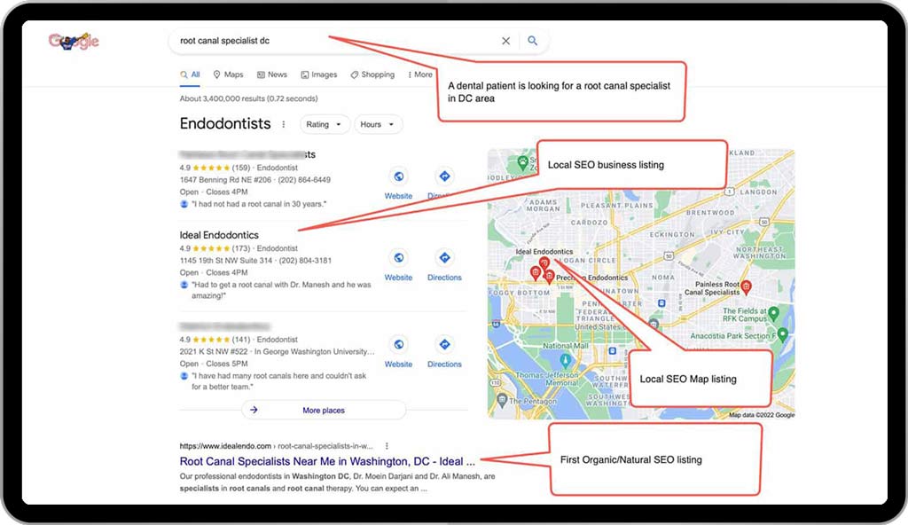 Example 4: Dental SEO for a endodontists  - root canal provider in Washington DC 