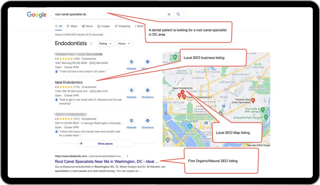 Example 2: Dental SEO for a dentist (Endodontist) in Washington DC