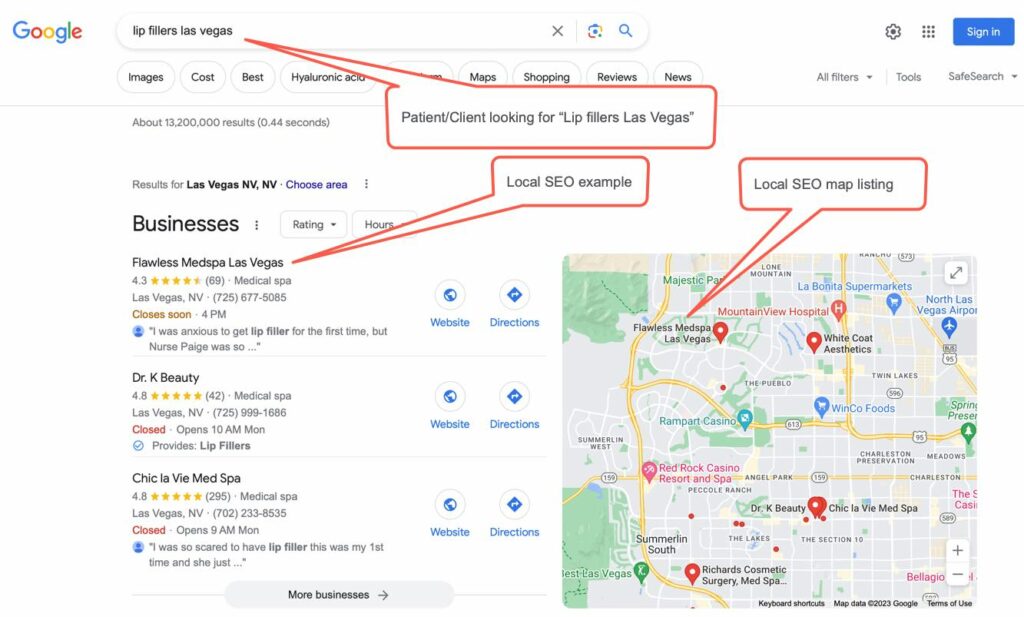 Example of Local SEO for "lip fillers in las vegas" Example of Local SEO for "lip fillers in las vegas"