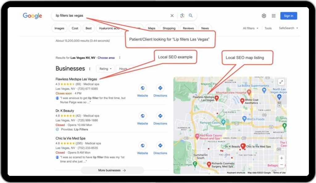 Example of Local SEO for a MedSpa Example of Local SEO for a MedSpa