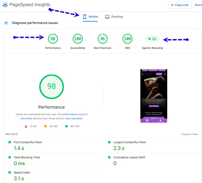 Example of fast loading mobile website of a dermatology practice using PLATINUM service from PatientGain. In this case add 2.3 + 3.1 - which is = 5.4 seconds. Then divide by 2 = 2.7 seconds. This is the real user experience captured by Google's PageSpeed test in the last 30 days - Anyone can can check the speed of any website. Important note - make sure you check the "Mobile" tab. Example of fast loading mobile website of a dermatology practice using PLATINUM service from PatientGain. In this case add 2.3 + 3.1 - which is = 5.4 seconds. Then divide by 2 = 2.7 seconds. This is the real user experience captured by Google's PageSpeed test in the last 30 days - Anyone can can check the speed of any website. Important note - make sure you check the "Mobile" tab.